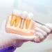 cost of dental implants panama city beach fl