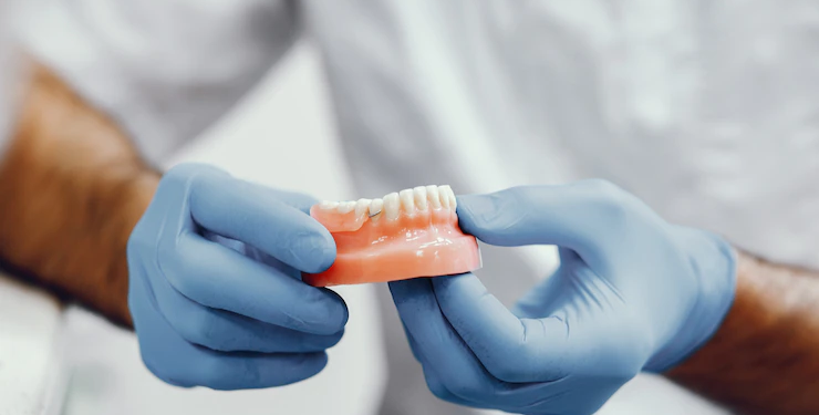 dental Bridges madison ms