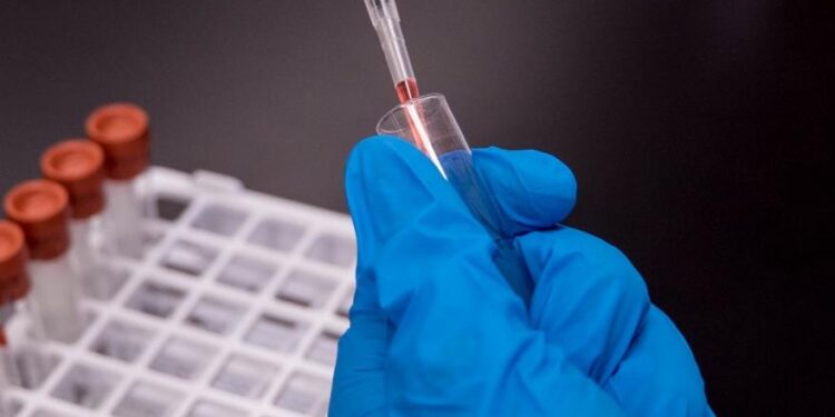 The Repercussions for Your Organization if You Ignore Drug Tests for Your Staff